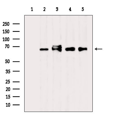 CSTF2T Antibody in Western Blot (WB)