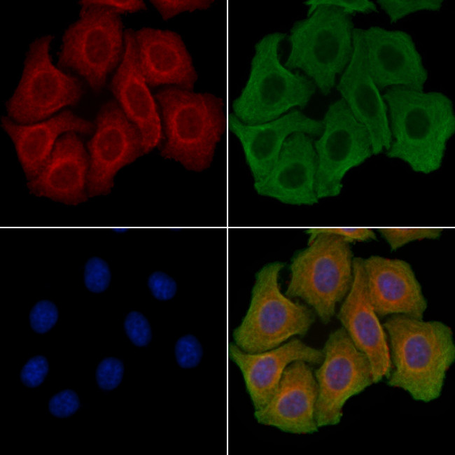 Complement C6 Antibody in Immunocytochemistry (ICC/IF)