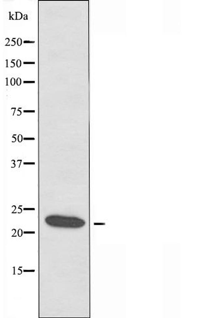 POLR3H Antibody in Western Blot (WB)