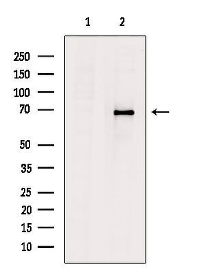 Epsin 3 Antibody in Western Blot (WB)