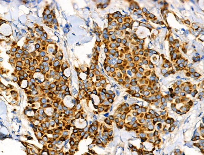 Folate Receptor alpha Antibody in Immunohistochemistry (Paraffin) (IHC (P))