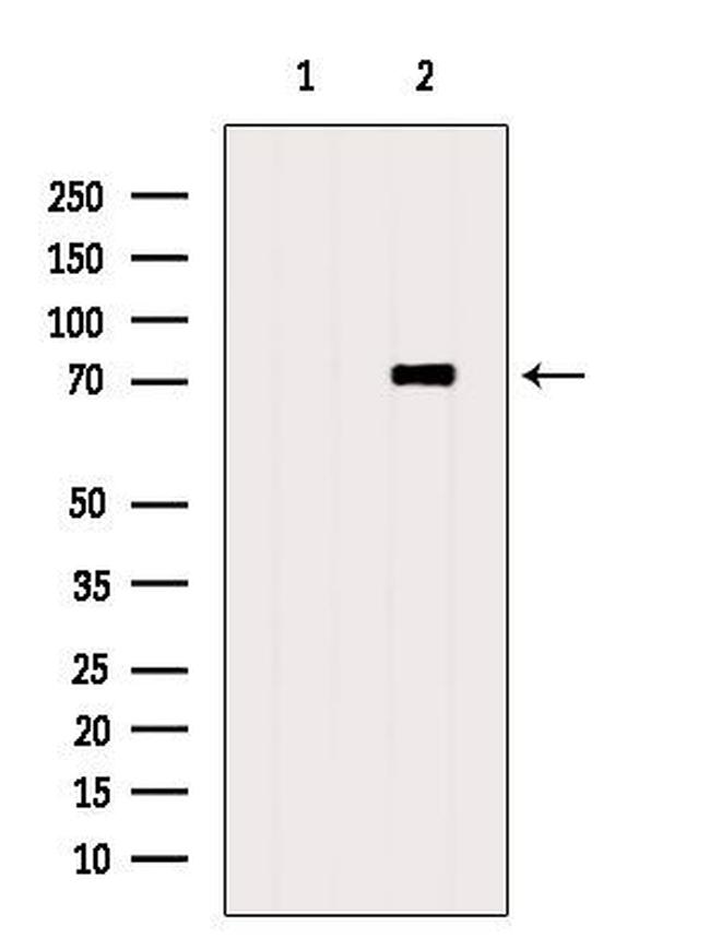 TSTA3 Antibody in Western Blot (WB)