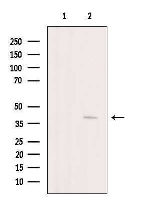 GNAL Antibody in Western Blot (WB)