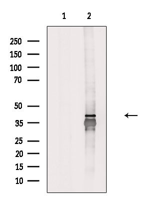 GNB5 Antibody in Western Blot (WB)