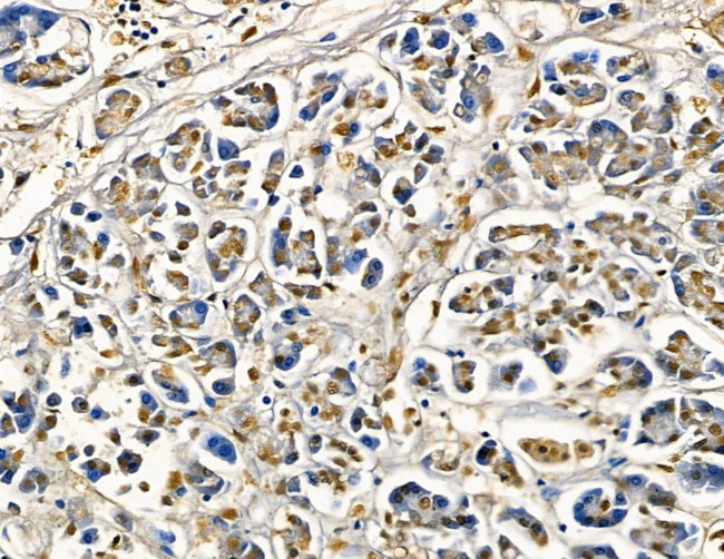 AASDHPPT Antibody in Immunohistochemistry (Paraffin) (IHC (P))