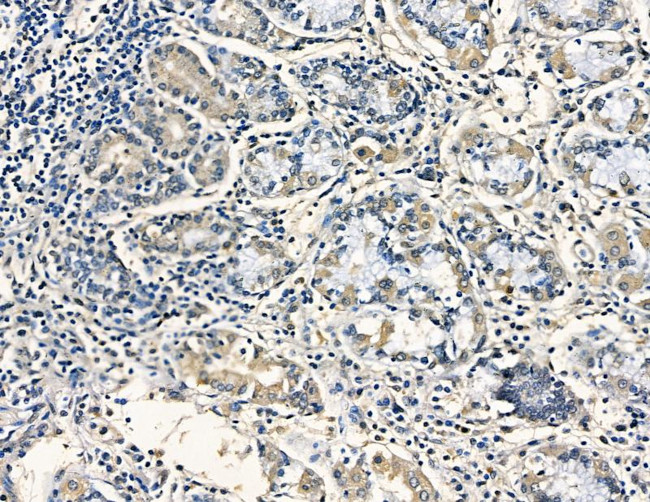 AASDHPPT Antibody in Immunohistochemistry (Paraffin) (IHC (P))