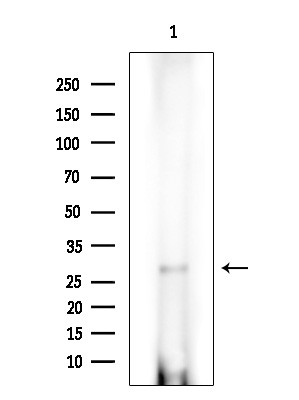 AASDHPPT Antibody in Western Blot (WB)