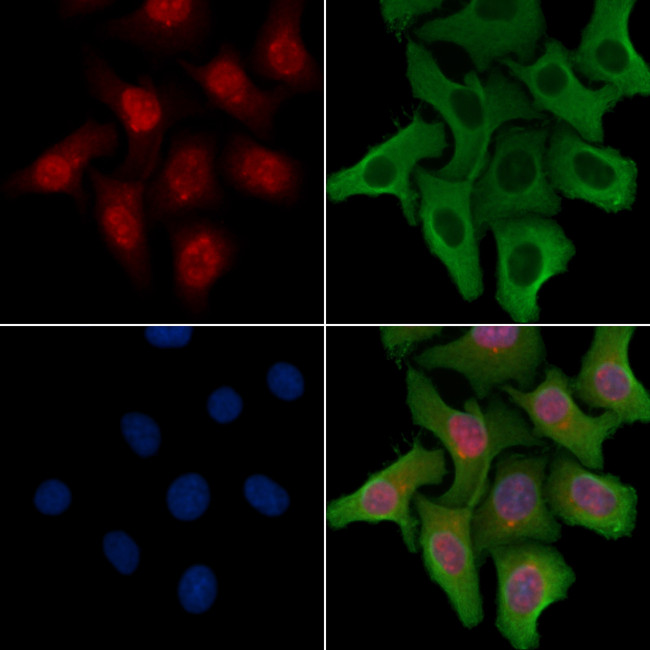 OGFR Antibody in Immunocytochemistry (ICC/IF)