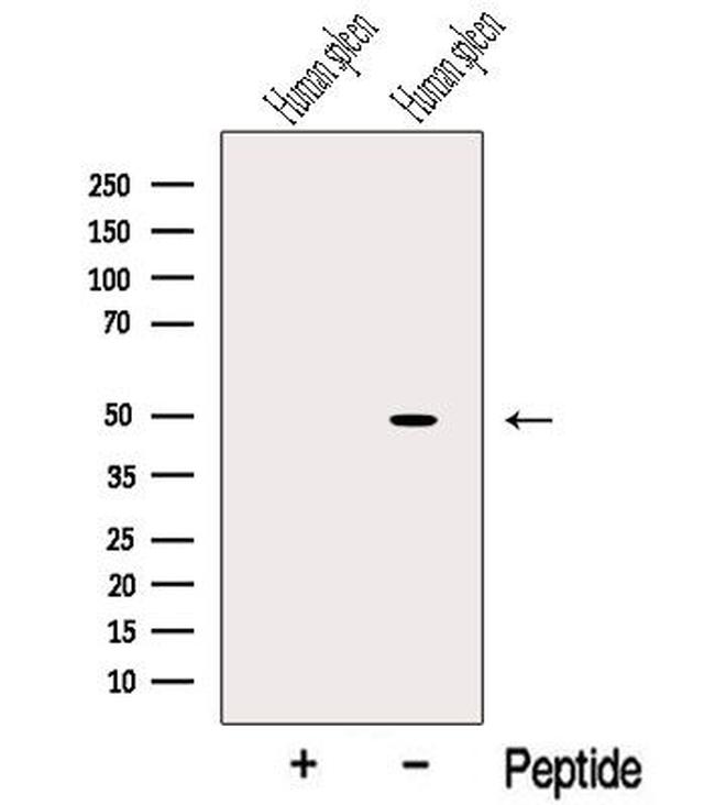 Protein C Inhibitor Antibody in Western Blot (WB)