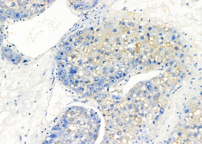 KCNK4 Antibody in Immunohistochemistry (Paraffin) (IHC (P))