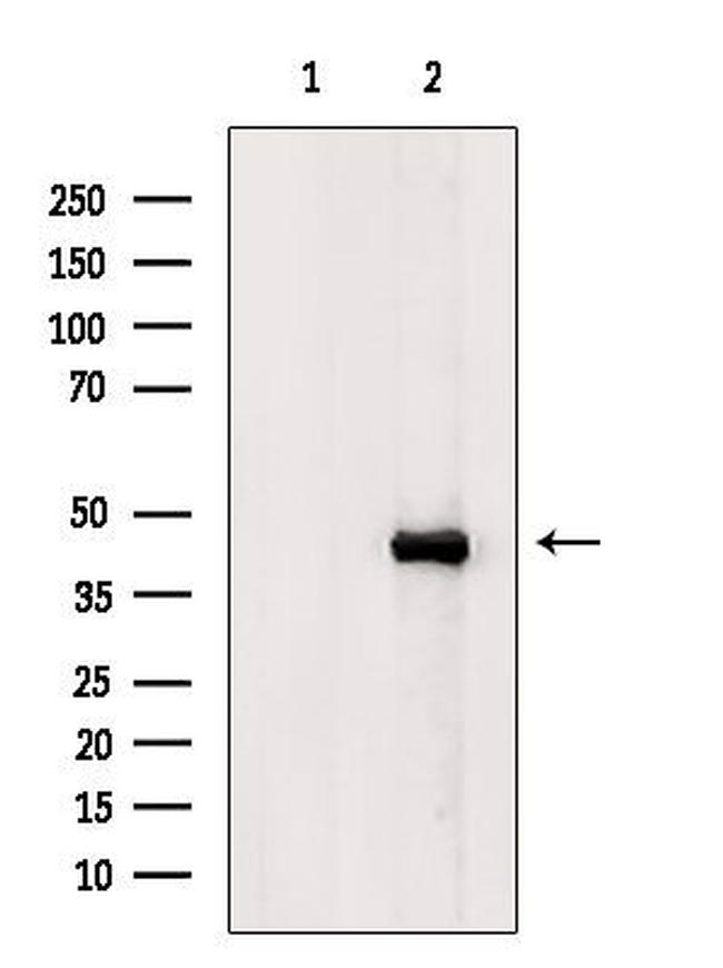 KCNK4 Antibody in Western Blot (WB)