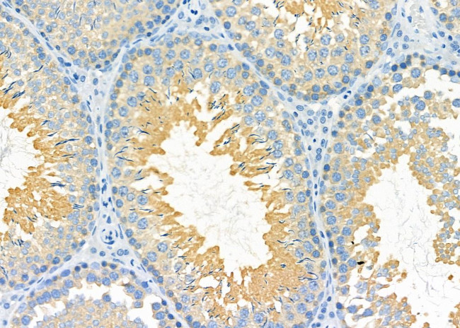 PDXDC1 Antibody in Immunohistochemistry (Paraffin) (IHC (P))