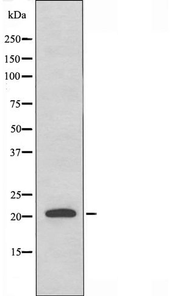 RAB31 Antibody in Western Blot (WB)