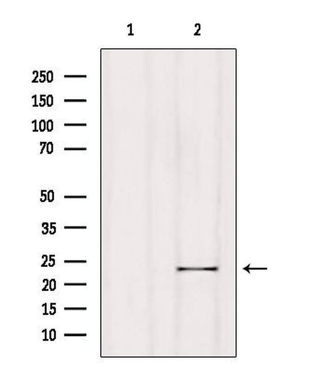 RGS1 Antibody in Western Blot (WB)