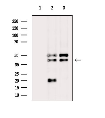 RIMKLA Antibody in Western Blot (WB)