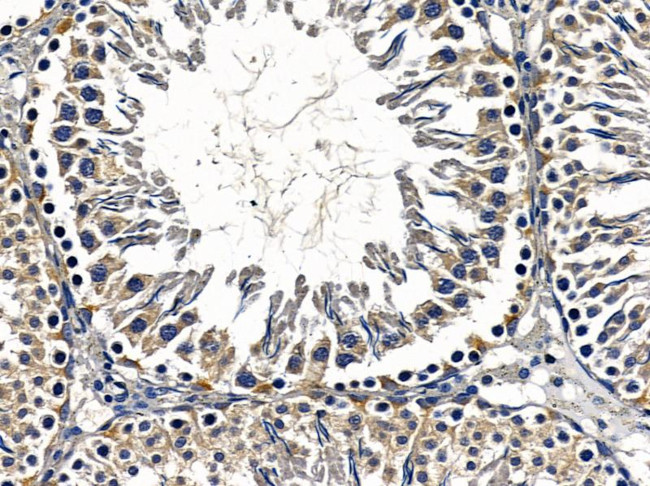 SHANK2 Antibody in Immunohistochemistry (Paraffin) (IHC (P))