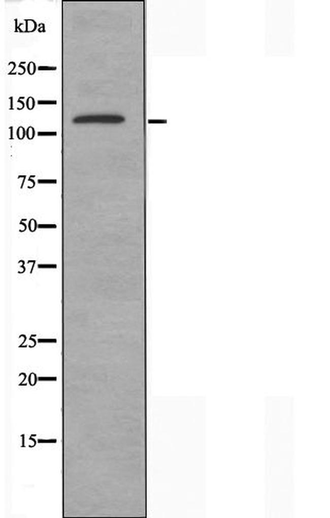 SHANK2 Antibody in Western Blot (WB)