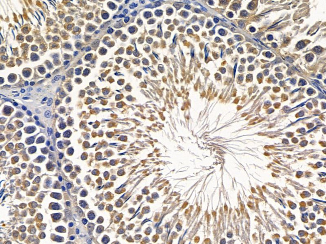 TCP-1 epsilon Antibody in Immunohistochemistry (Paraffin) (IHC (P))