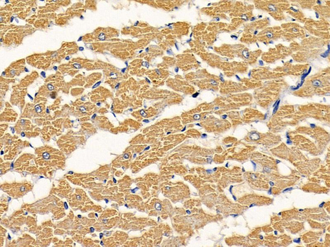 TCP-1 epsilon Antibody in Immunohistochemistry (Paraffin) (IHC (P))