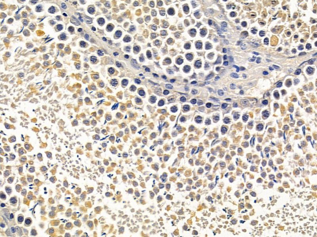 TCP-1 epsilon Antibody in Immunohistochemistry (Paraffin) (IHC (P))