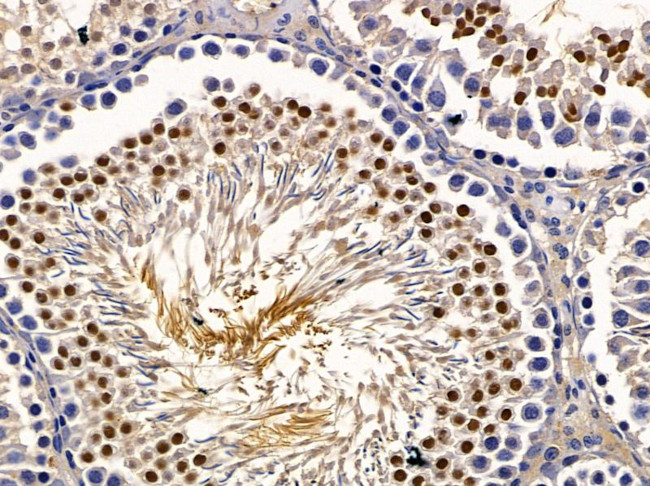 ZNF575 Antibody in Immunohistochemistry (Paraffin) (IHC (P))