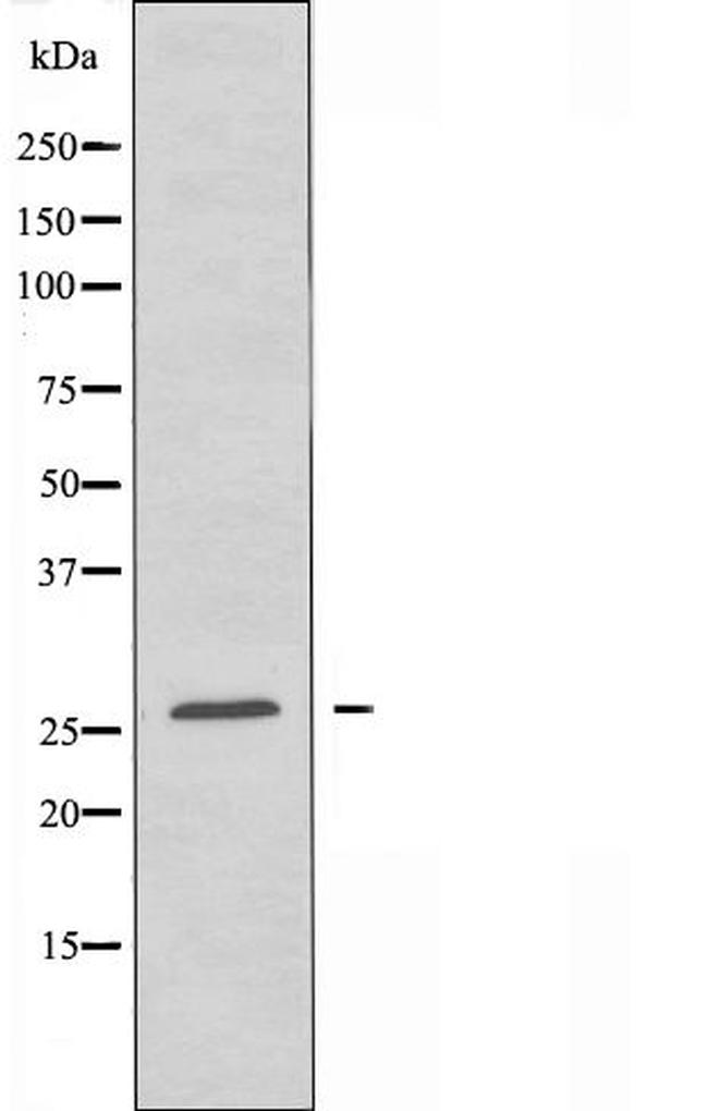 ZNF575 Antibody in Western Blot (WB)