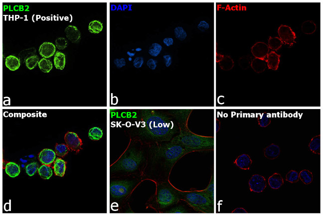 PLCB2 Antibody in Immunocytochemistry (ICC/IF)