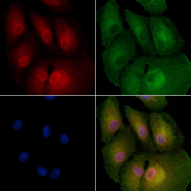 BCL7A Antibody in Immunocytochemistry (ICC/IF)