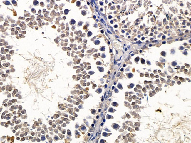 BCL7A Antibody in Immunohistochemistry (Paraffin) (IHC (P))