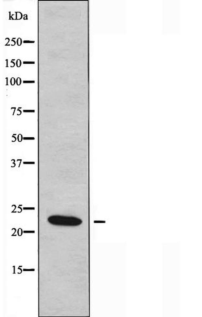 BCL7A Antibody in Western Blot (WB)