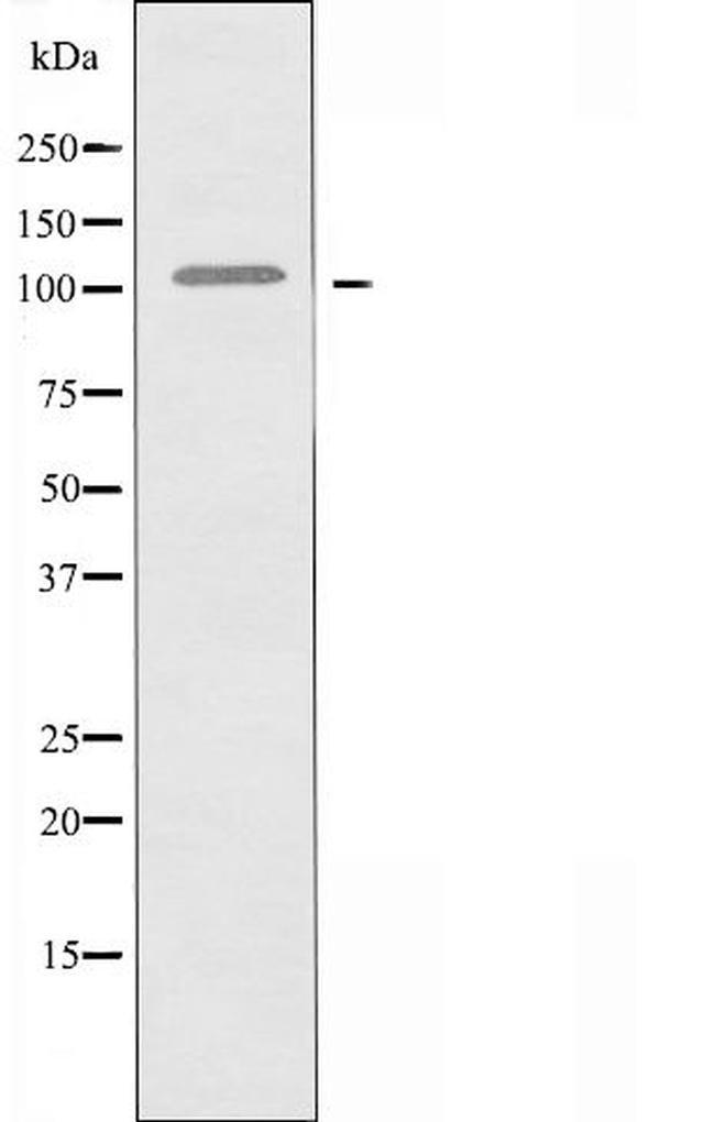 FCRL5 Antibody in Western Blot (WB)