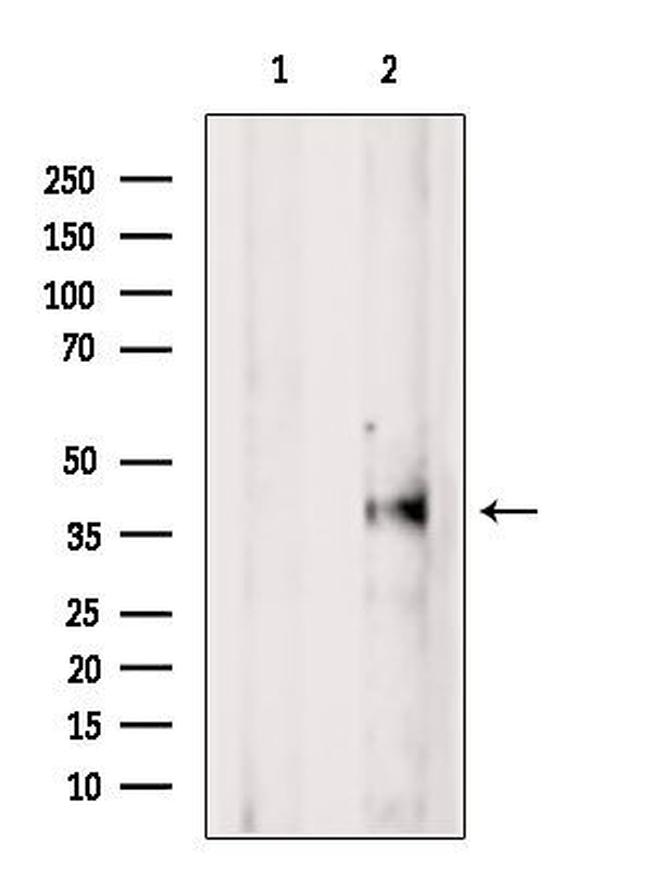 VASH1 Antibody in Western Blot (WB)