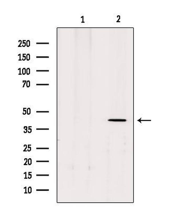 MTNR1B Antibody in Western Blot (WB)