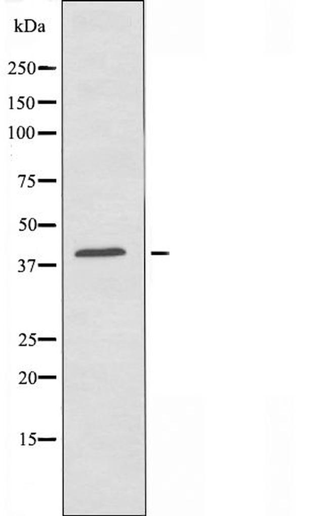 OR10V1 Antibody in Western Blot (WB)