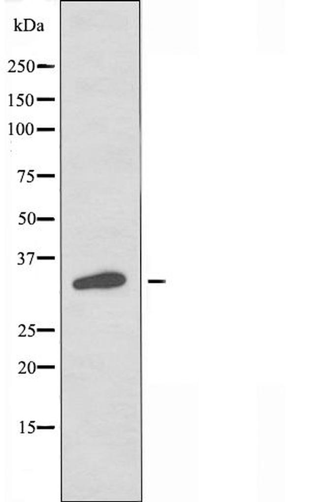 OR2M2 Antibody in Western Blot (WB)