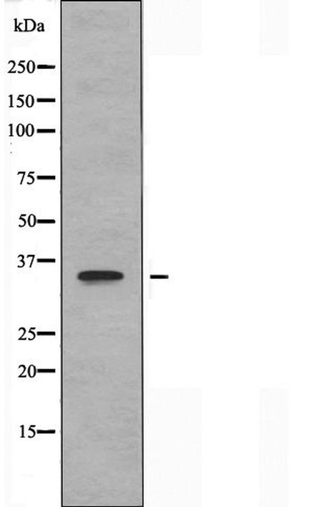 OR8I2 Antibody in Western Blot (WB)