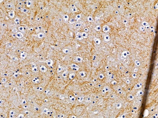 OR10G7 Antibody in Immunohistochemistry (Paraffin) (IHC (P))