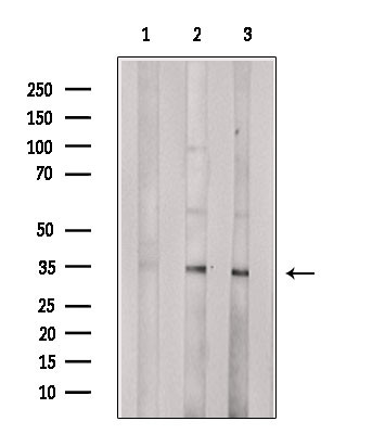 OR10G7 Antibody in Western Blot (WB)