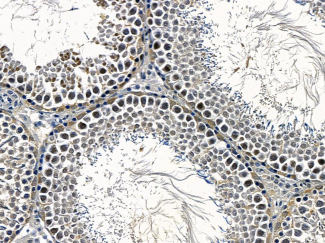 Cytomegalovirus US28 Antibody in Immunohistochemistry (Paraffin) (IHC (P))