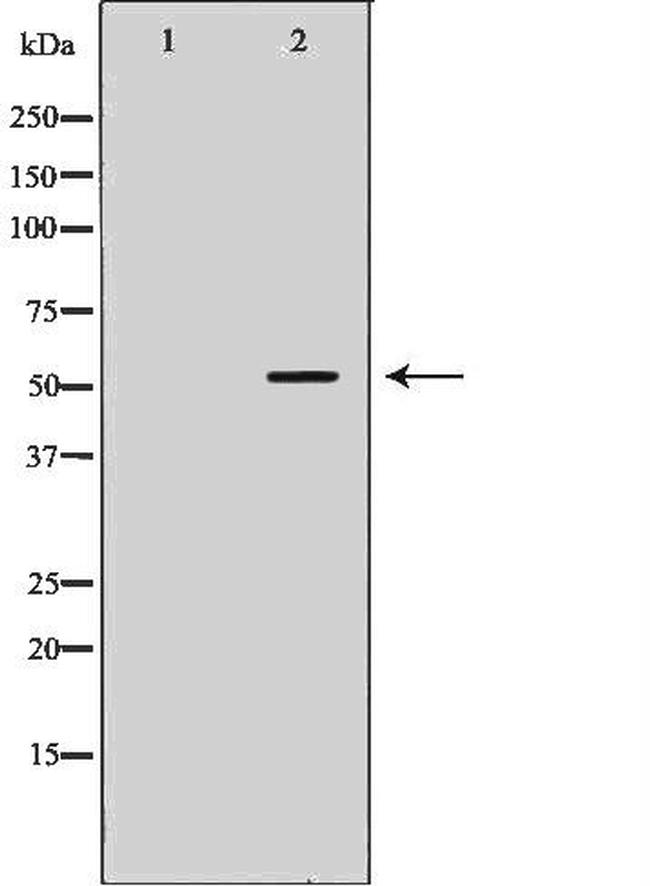 STEAP3 Antibody in Western Blot (WB)