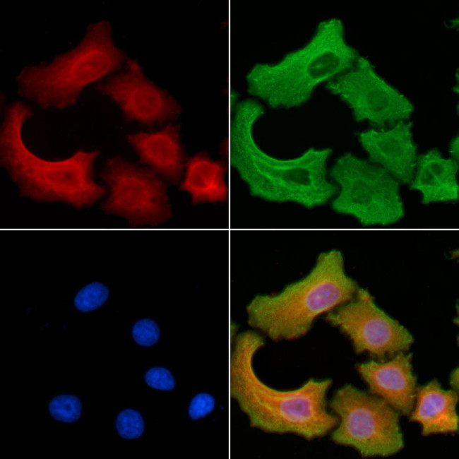 ATG13 Antibody in Immunocytochemistry (ICC/IF)