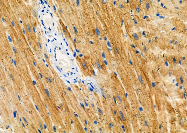 ATG13 Antibody in Immunohistochemistry (Paraffin) (IHC (P))