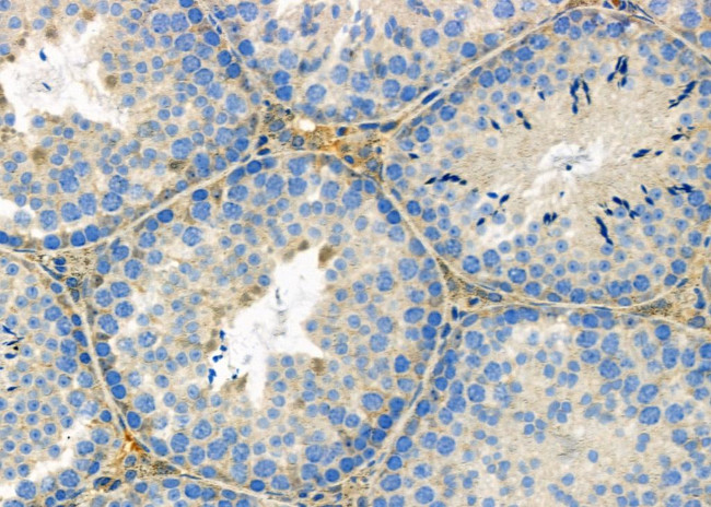 ATG13 Antibody in Immunohistochemistry (Paraffin) (IHC (P))