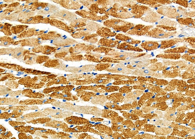 ATG13 Antibody in Immunohistochemistry (Paraffin) (IHC (P))