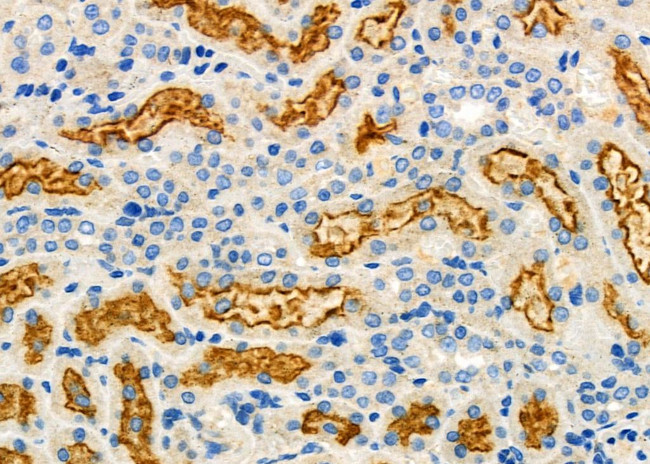 ATG13 Antibody in Immunohistochemistry (Paraffin) (IHC (P))