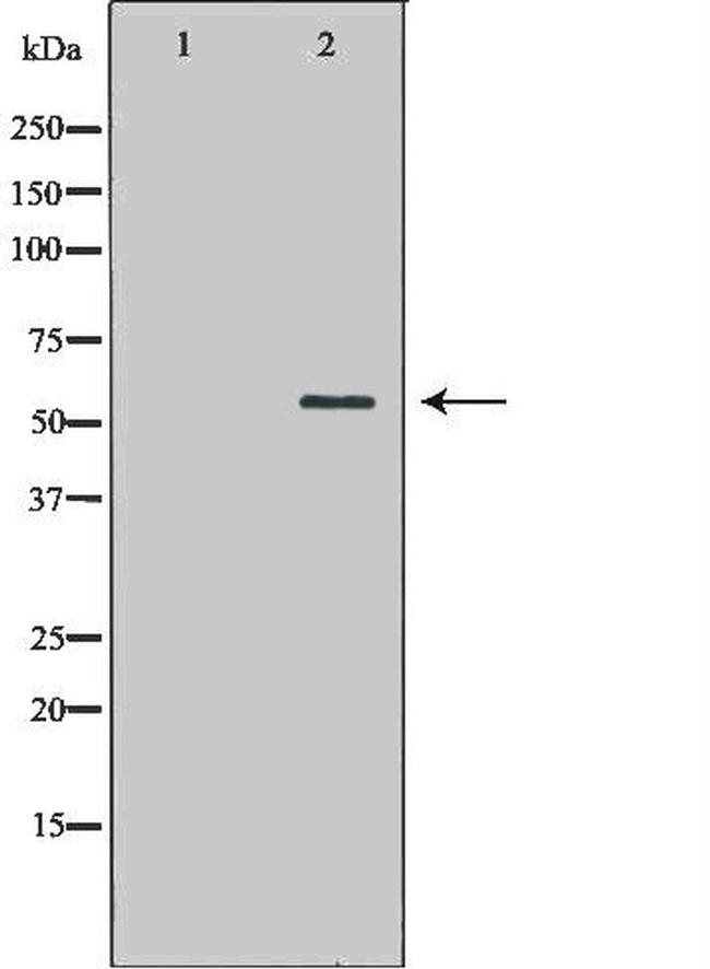 ATG13 Antibody in Western Blot (WB)