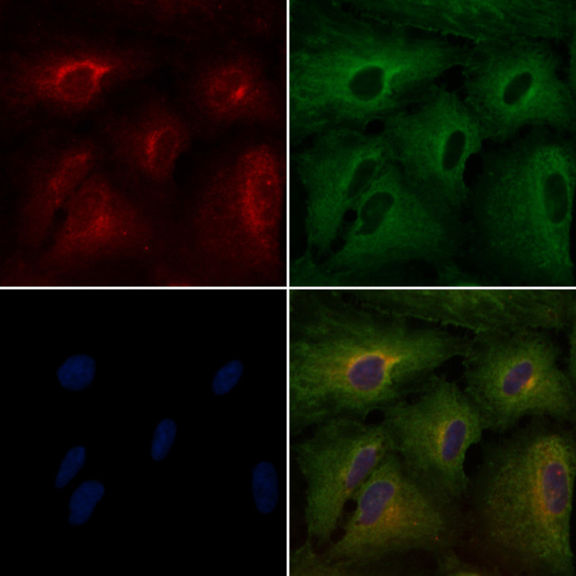 SPINK1 Antibody in Immunocytochemistry (ICC/IF)