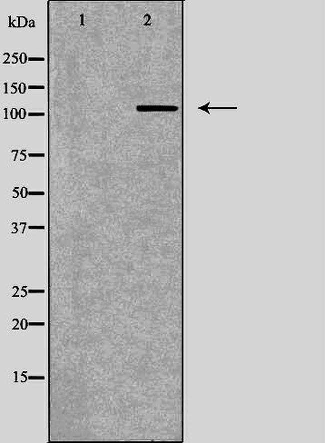 SERCA2 ATPase Antibody in Western Blot (WB)