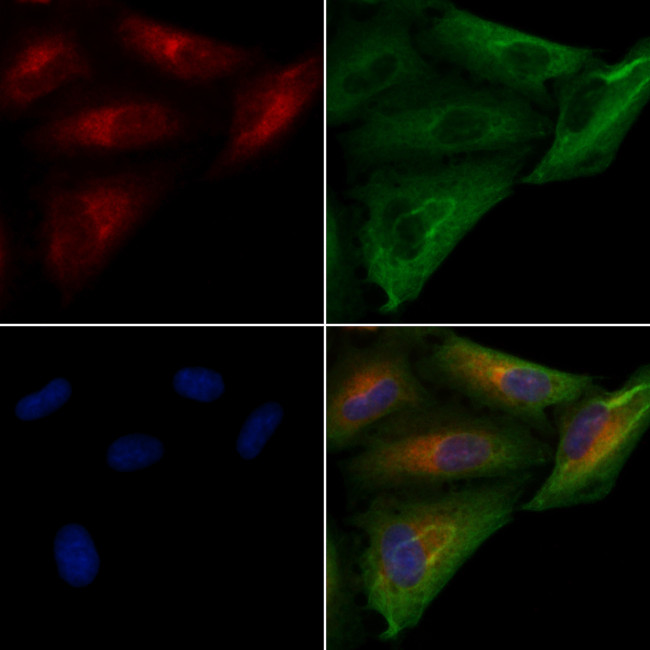 SERCA2 ATPase Antibody in Immunocytochemistry (ICC/IF)