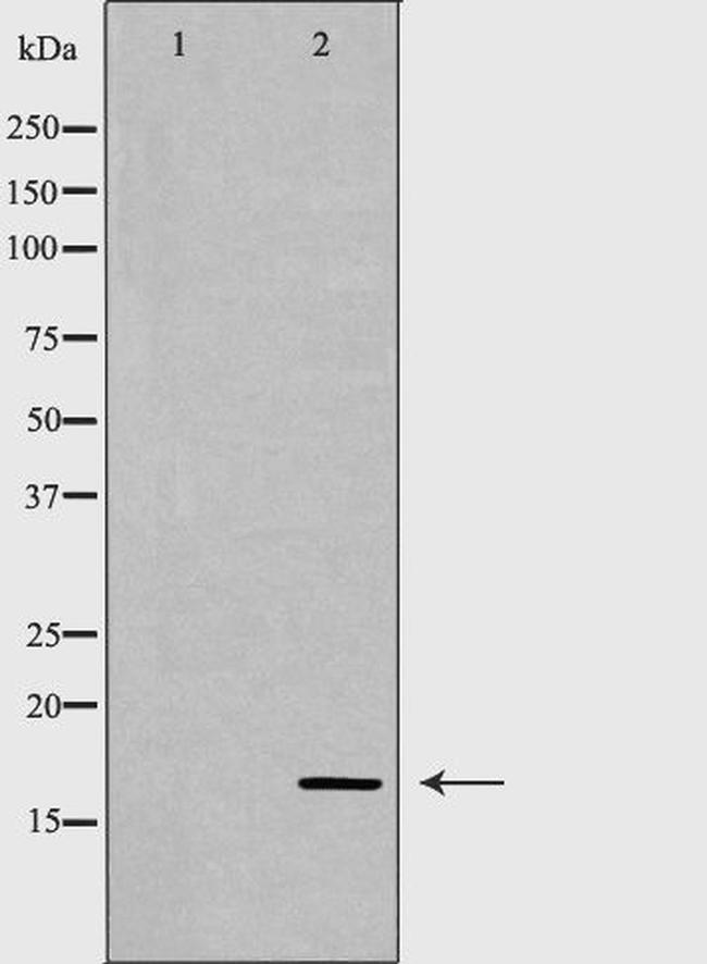Calmodulin 1/2/3 Antibody in Western Blot (WB)
